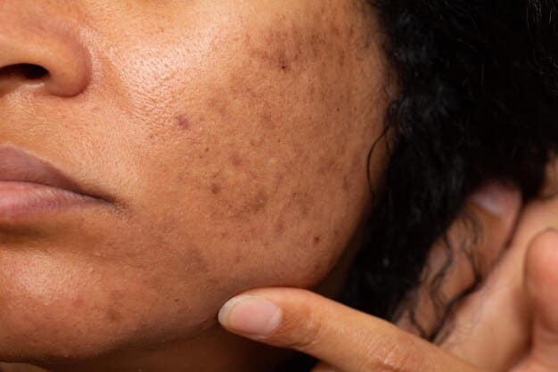 closeup asian woman with dark spots freckles problems 651462 201